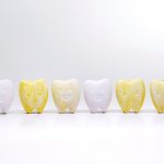 Illustration de dents jaunies par des accumulations de tartre